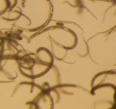 Multiple small nematode worms